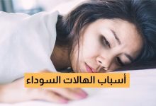 صورة أسباب الهالات السوداء وعلاجها بطرق طبيعية